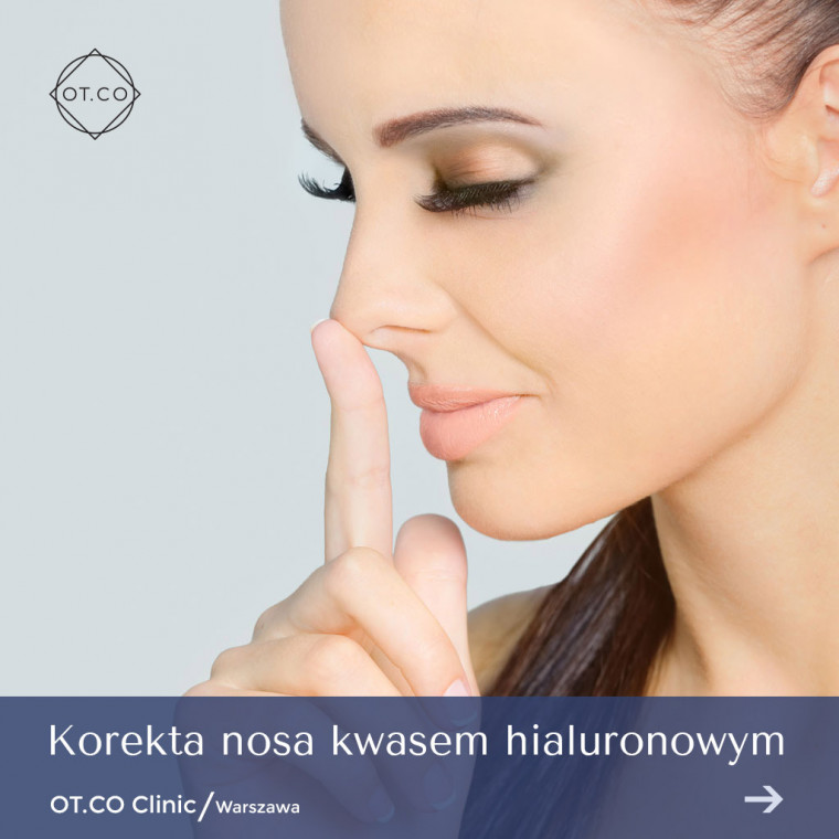 korekta nosa kwasem hialuronowym
